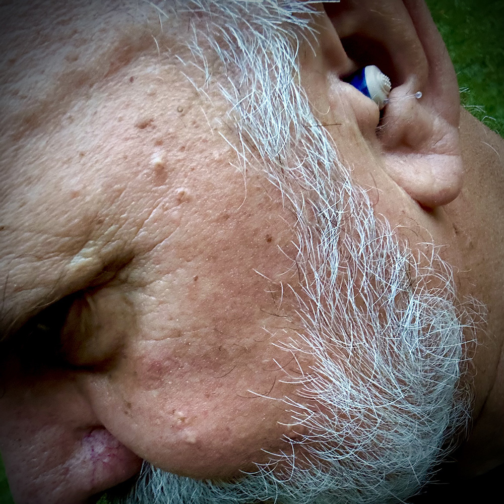 Doc wearing his new hearing aids.